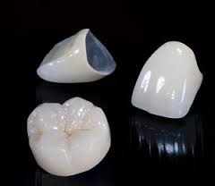 dental crown