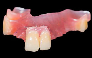 Complete/Partial Dentures 